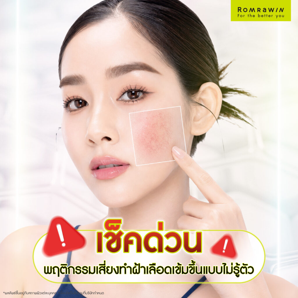 ฝ้าเลือดคืออะไร? ส่องสาเหตุ เช็กพฤติกรรมเสี่ยง พร้อมวิธีรักษาฝ้าที่เหมาะสม 6 เช็กด่วน! พฤติกรรมเสี่ยงทำฝ้าเลือดเข้มขึ้นแบบไม่รู้ตัว