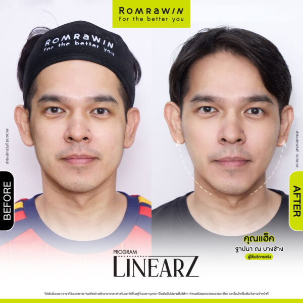 All Review 269 รีวิว Linear Z คุณแฮ็ก