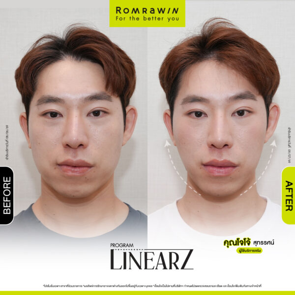 All Review 268 รีวิว Linear Z คุณโจโจ้