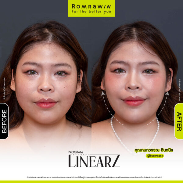 All Review 263 รีวิว Linear Z คุณกนกนวรรณ