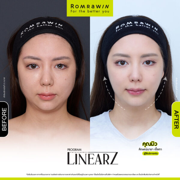 All Review 267 รีวิว Linear Z คุณมิว