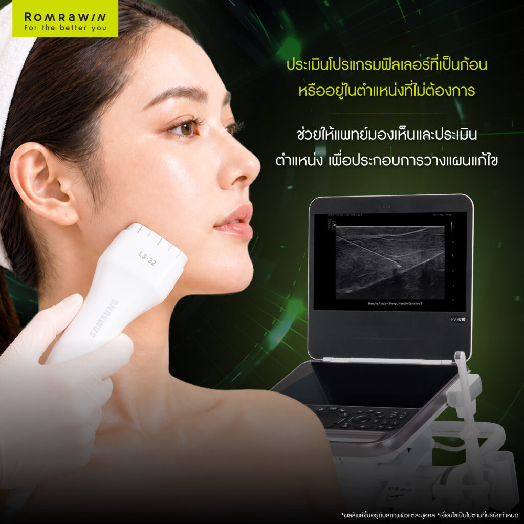 Samsung EVO Q10 ตัวช่วยวางแผนการรักษาในคลินิกเสริมความงาม 6 ช่วยประเมินฟิลเลอร์ที่เป็นก้อนหรืออยู่ในตำแหน่งที่ไม่ต้องการ