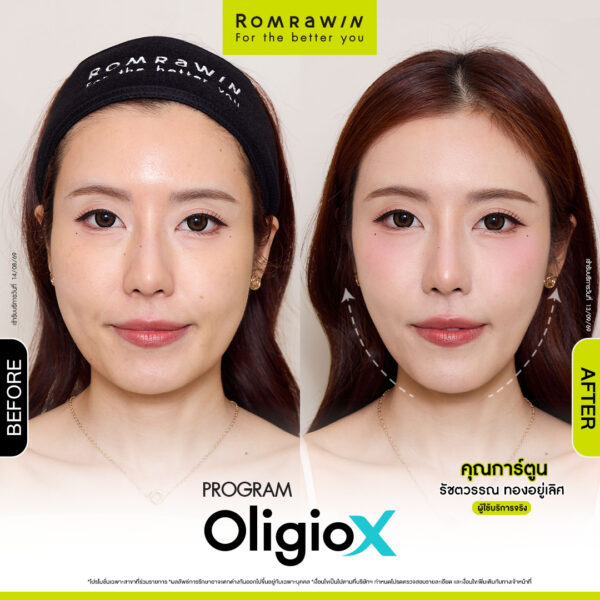 All Review 27 รีวิว OligioX คุณการ์ตูน