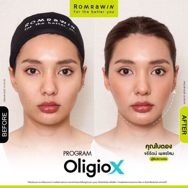 All Review 25 รีวิว OligioX คุณใบตอง