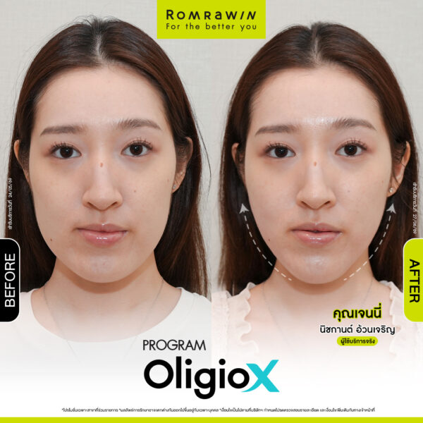 All Review 24 รีวิว OligioX คุณเจนนี่
