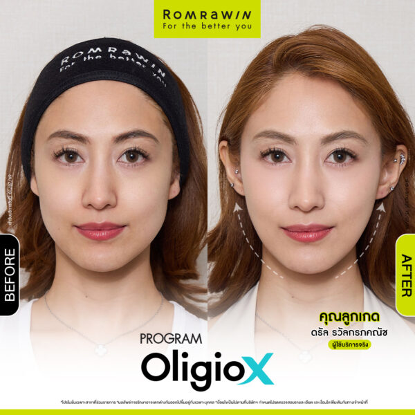 All Review 32 รีวิว OligioX คุณลูกเกด