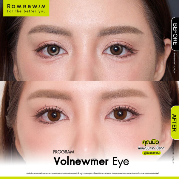 All Review 271 รีวิว Volnewmer eye คุณมิว
