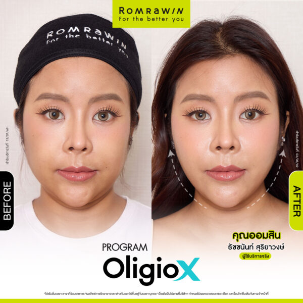 All Review 31 รีวิว OligioX คุณออมสิน