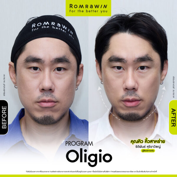 All Review 12 รีวิว Oligio คุณคิว