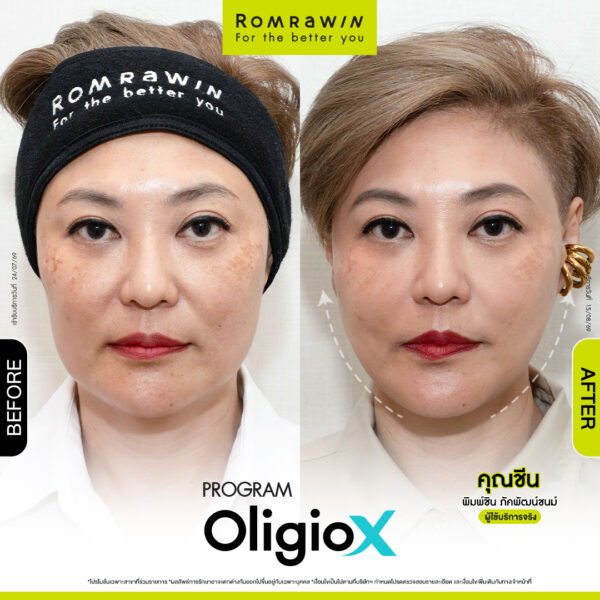 All Review 30 รีวิว OligioX คุณชีน