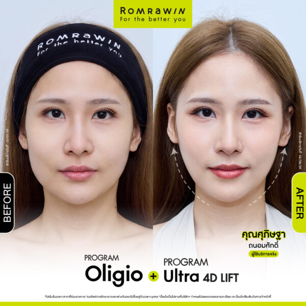 All Review 13 รีวิว Oligio คุณศุภิษฐา