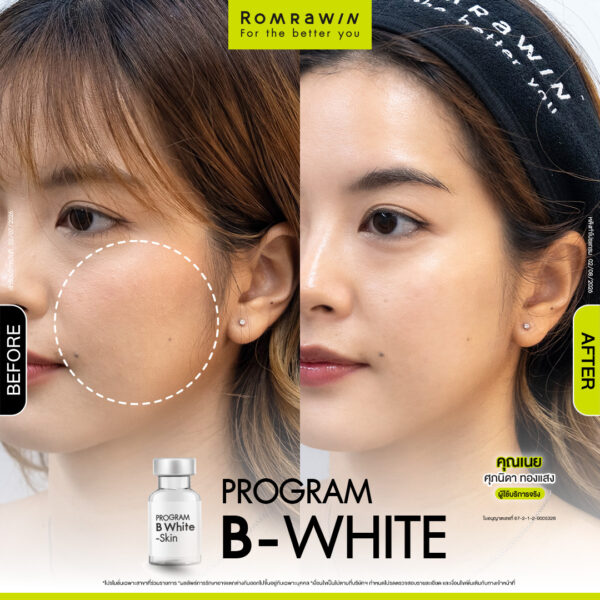 All Review 261 รีวิว B-White คุณเนย
