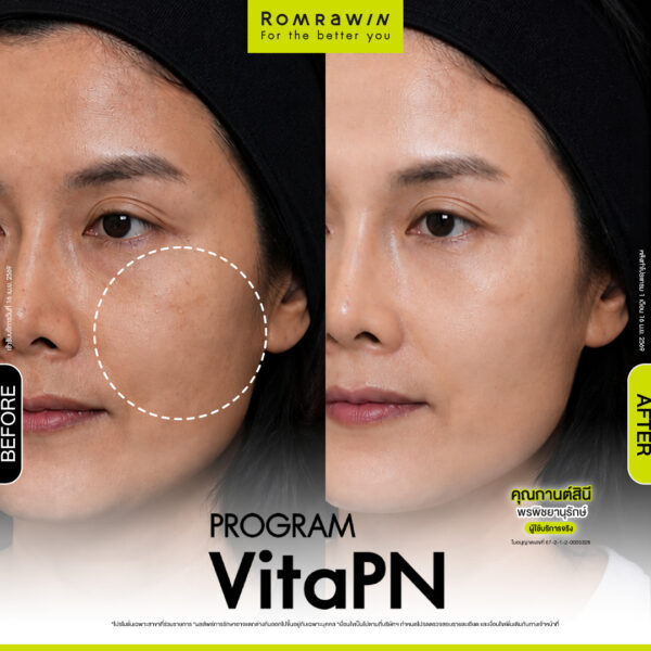 All Review 140 รีวิว Vitaran คุณกาต์สินี