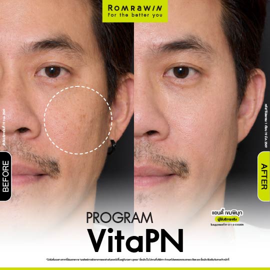 All Review 137 รีวิว Vitaran คุณแอนดี้
