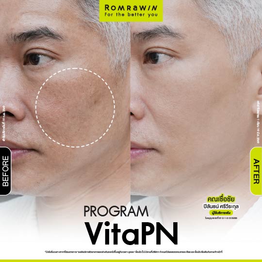 All Review 145 รีวิว Vitaran คุณเชื่อชัย