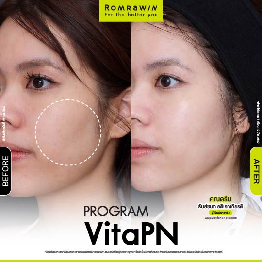 All Review 144 รีวิว Vitaran คุณดรีม