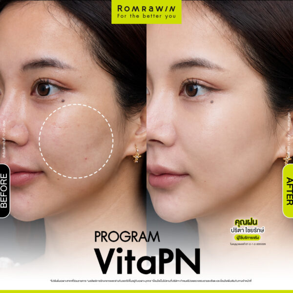 All Review 143 รีวิว Vitaran คุณฝน