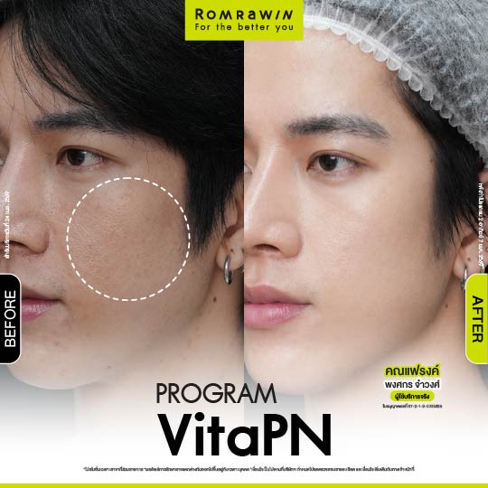 All Review 142 รีวิว Vitaran คุณแฟรงค์