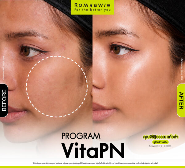 All Review 136 รีวิว Vitaran คุณจิรัฐวรรณ