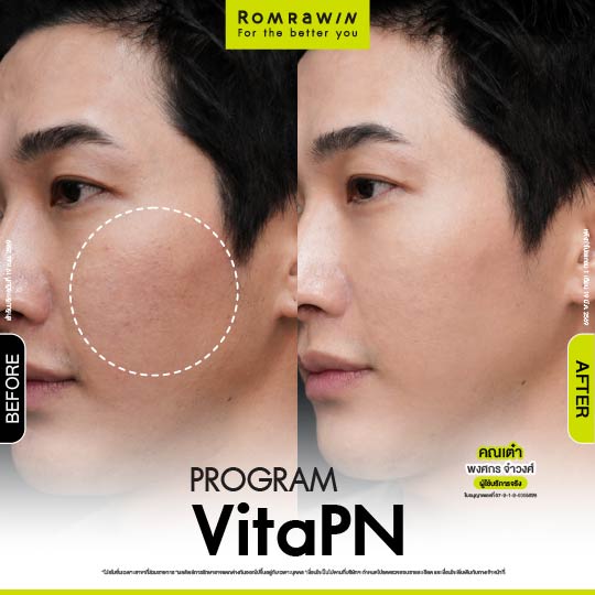 All Review 139 รีวิว Vitaran คุณเต๋า