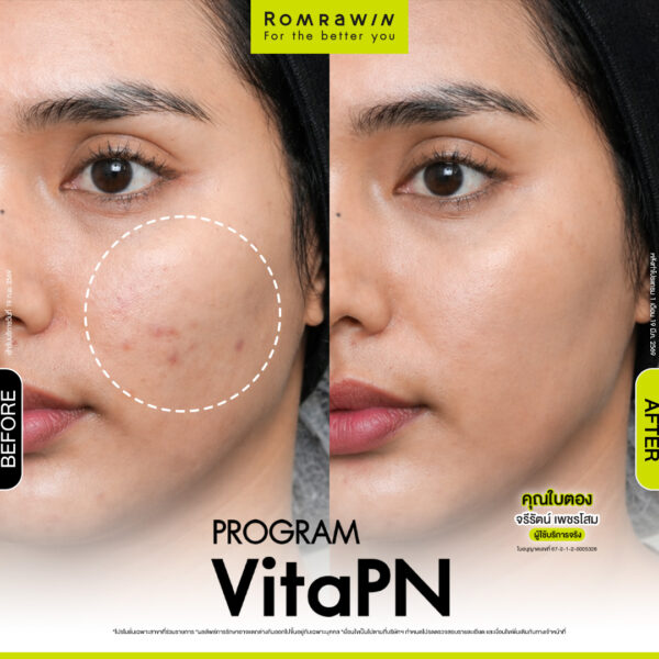 All Review 138 รีวิว Vitaran คุณใบตอง