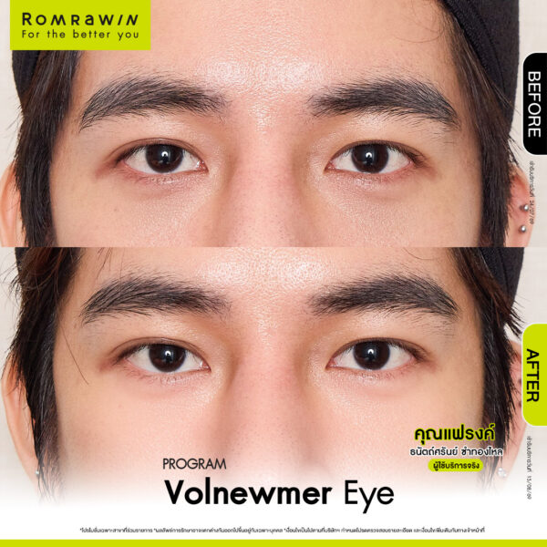 All Review 270 รีวิว Volnewmer eye คุณแฟรงค์