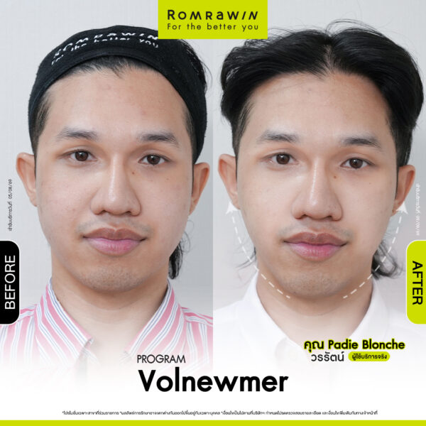 All Review 273 รีวิว Volnewmer คุณ Padie Blonche