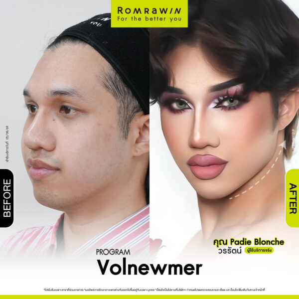 All Review 277 รีวิว Volnewmer คุณ Padie Blonche