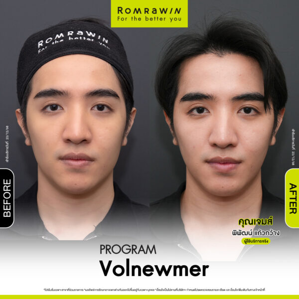 All Review 275 รีวิว Volnewmer คุณเจมส์