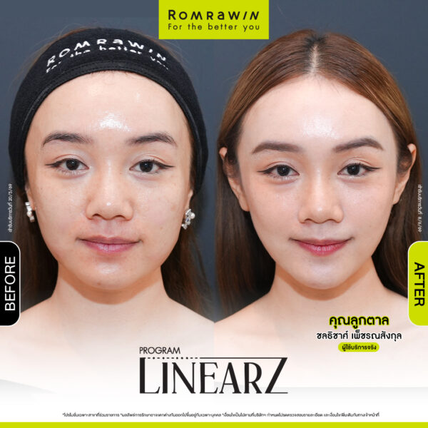 All Review 264 รีวิว Linear Z คุณลูกตาล