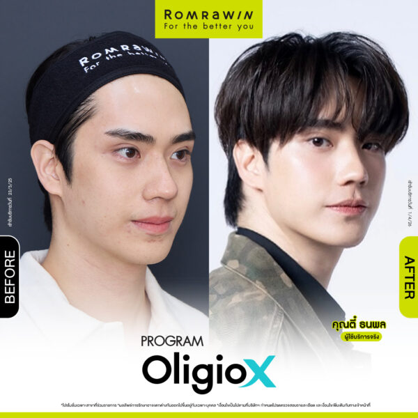 All Review 28 รีวิว OligioX คุณตี๋