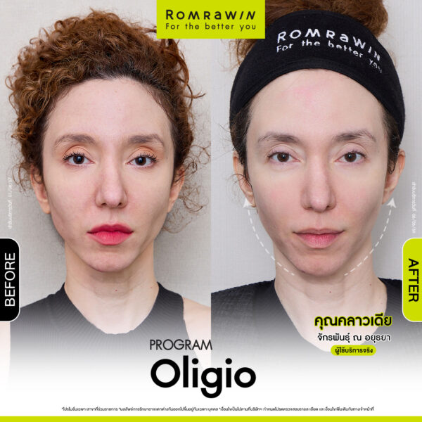 All Review 14 รีวิว Oligio คุณคลาวเดีย
