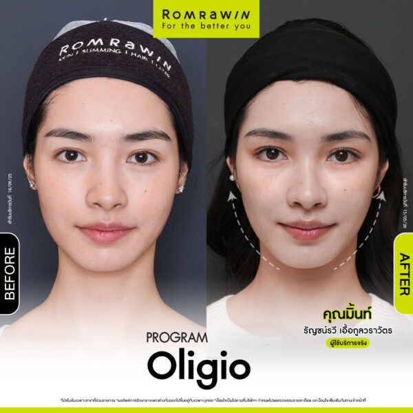 All Review 15 รีวิว Oligio คุณมินท์
