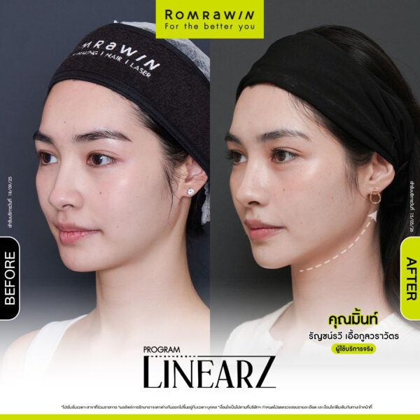 All Review 266 รีวิว Linear Z คุณมินท์