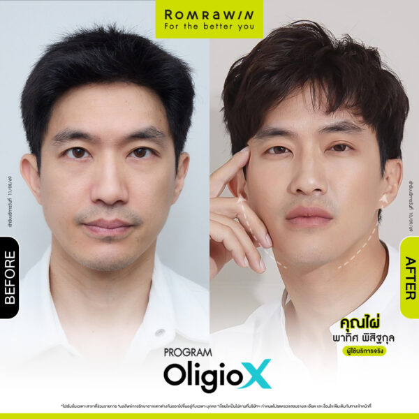 All Review 29 รีวิว OligioX คุณไผ่