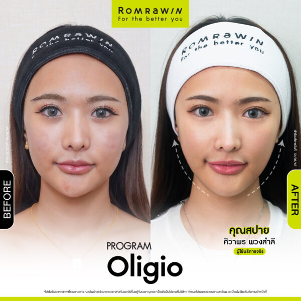 All Review 16 รีวิว Oligio คุณสปาย