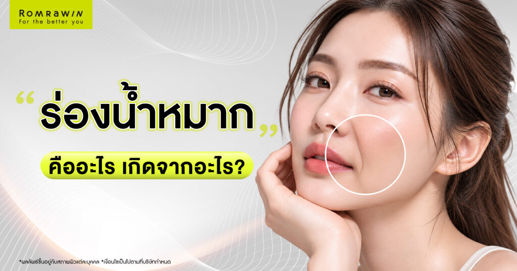 ร่องน้ำหมากคืออะไร? เกิดจากอะไร พร้อมวิธีแก้ด้วยเครื่องยกกระชับและโปรแกรมฉีดฟิลเลอร์ 1 ร่องน้ำหมากคืออะไร? เกิดจากอะไร พร้อมวิธีแก้ด้วยเครื่องยกกระชับและโปรแกรมฉีดฟิลเลอร์