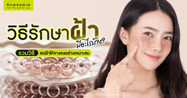 รวมวิธีรักษาฝ้า