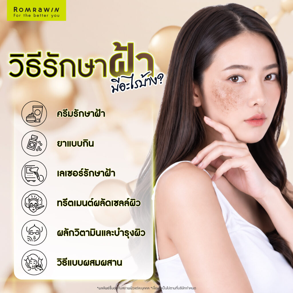 รวมวิธีรักษาฝ้ามีอะไรบ้าง?