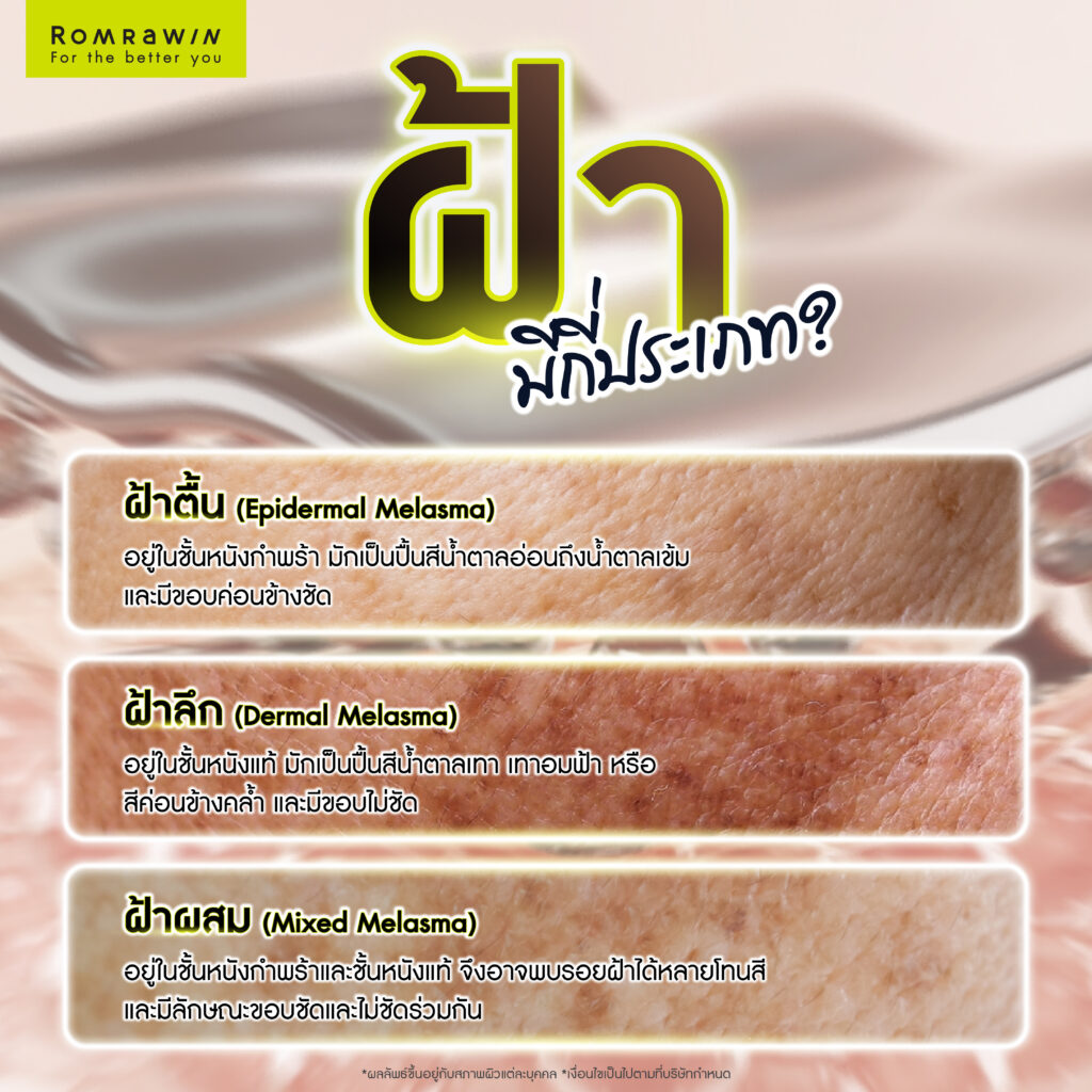 ฝ้ามีกี่ประเภท