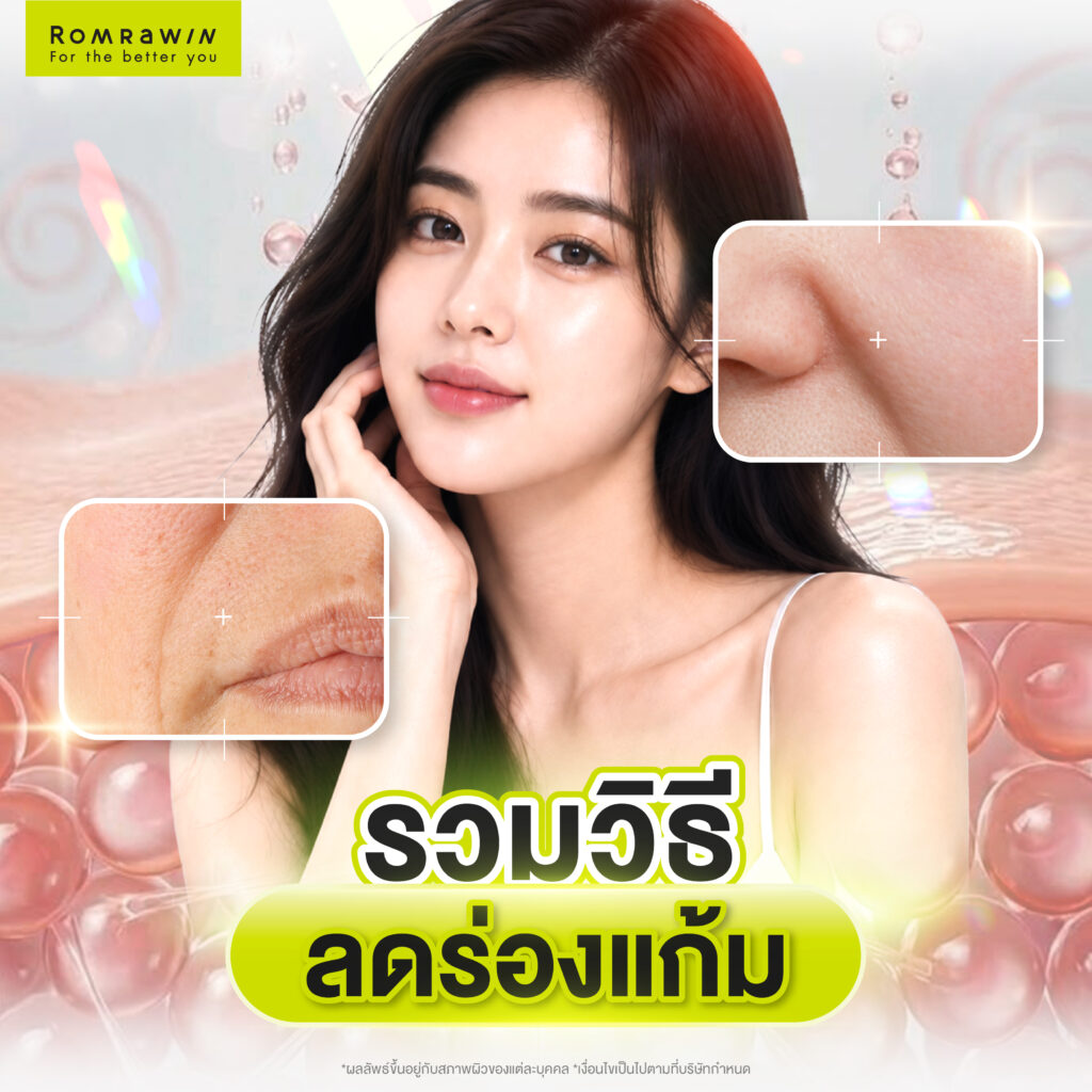 ร่องแก้มลึกแก้อย่างไร? รวมสาเหตุ และเจาะลึกวิธีลดร่องแก้ม 3 รวมวิธีลดร่องแก้ม