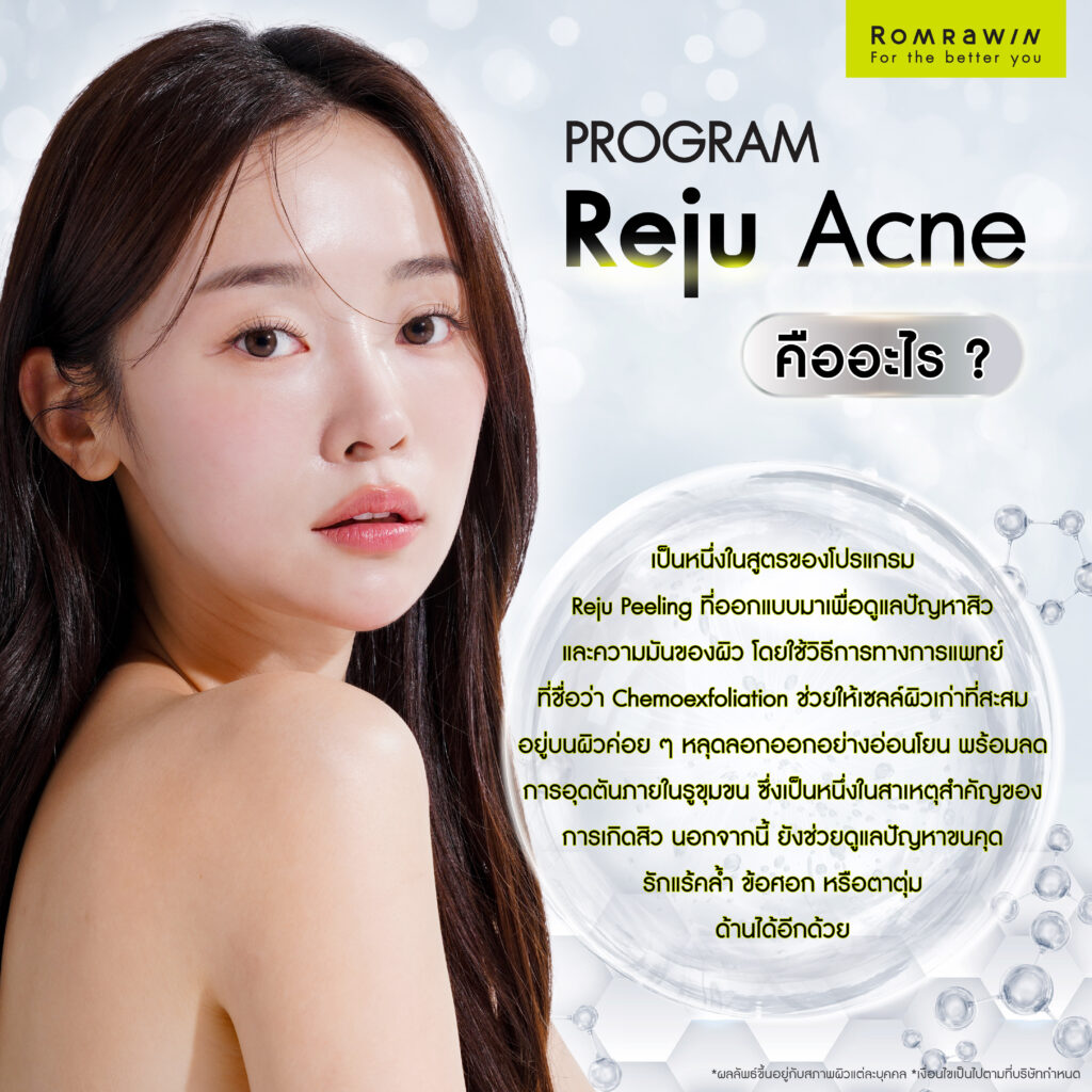 Reju Acne เคล็ดลับเคลียร์ปัญหาสิว พร้อมกู้ผิวหยาบกร้าน 2 Reju Acne คืออะไร?