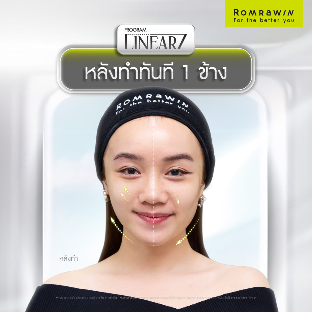 รีวิว Linear Z คุณลูกตาล