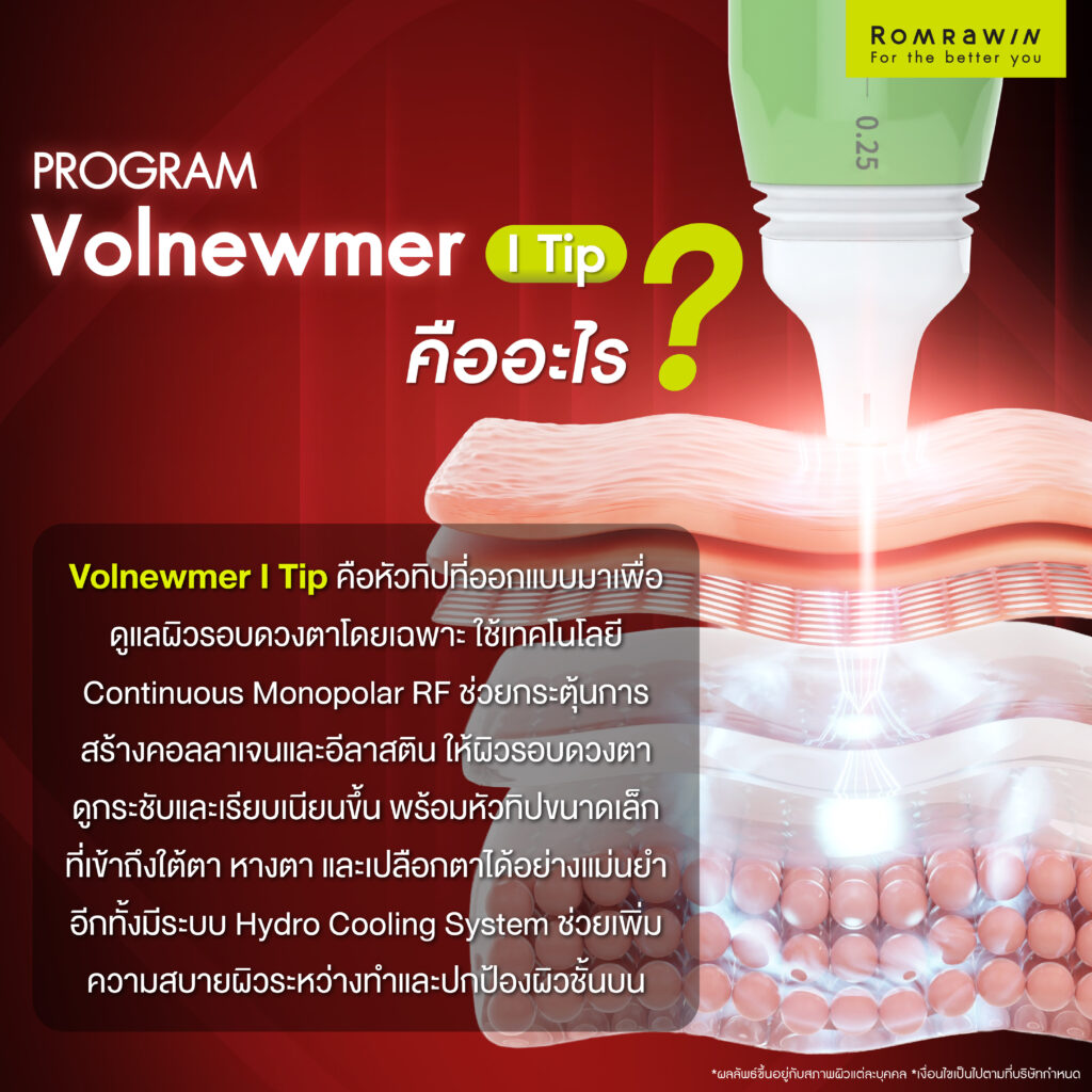 เจาะลึก Volnewmer I Tip เทคโนโลยีสำหรับผิวบริเวณรอบดวงตาโดยเฉพาะ 2 Volnewmer I Tip คืออะไร?
