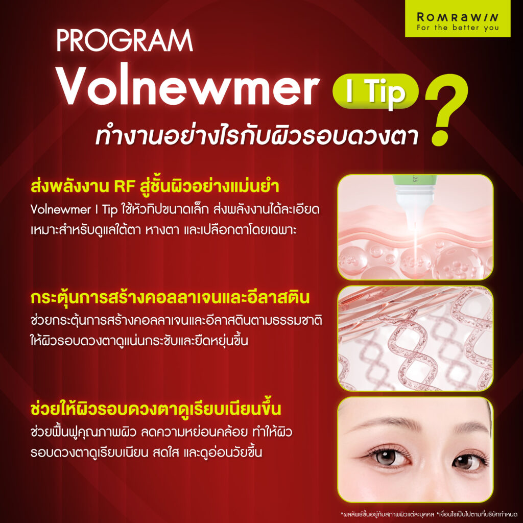 เจาะลึก Volnewmer I Tip เทคโนโลยีสำหรับผิวบริเวณรอบดวงตาโดยเฉพาะ 3 Volnewmer I Tip ทำงานอย่างไรกับผิวรอบดวงตา?
