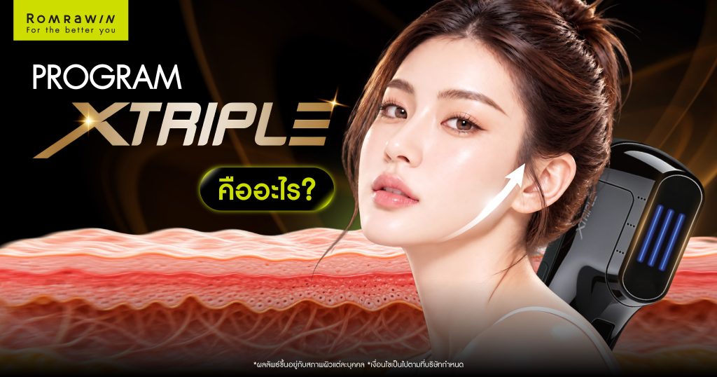 XTRIPLE คืออะไร? รู้จักเทคโนโลยียกกระชับ อื่นๆอย่างไร 1 XTRIPLE