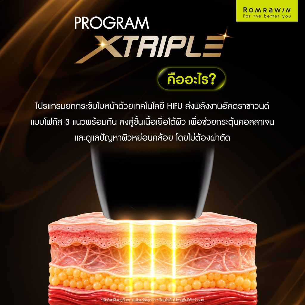 XTRIPLE คืออะไร? รู้จักเทคโนโลยียกกระชับ อื่นๆอย่างไร 2 XTRIPLE คืออะไร?