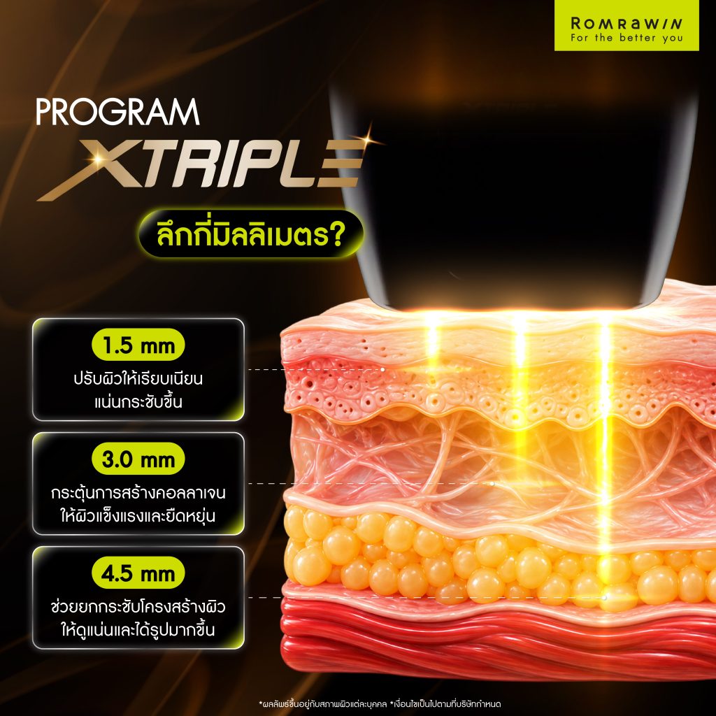 XTRIPLE คืออะไร? รู้จักเทคโนโลยียกกระชับ อื่นๆอย่างไร 4 XTRIPLE ส่งพลังงานลึกกี่มิลลิเมตร?
