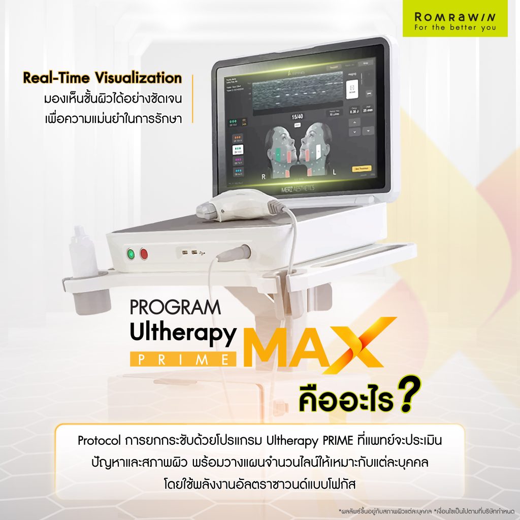 Ultherapy PRIME MAX คืออะไร?