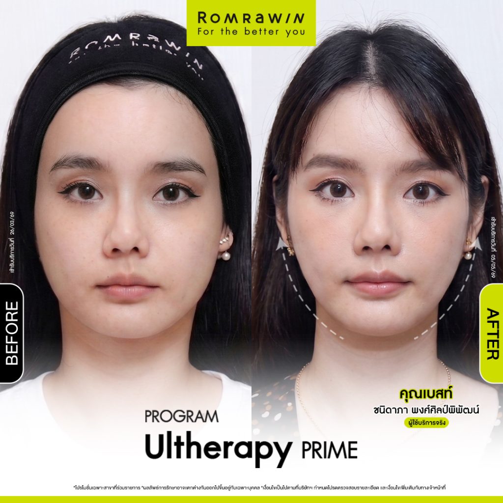 เบสท์ ชนิดาภา